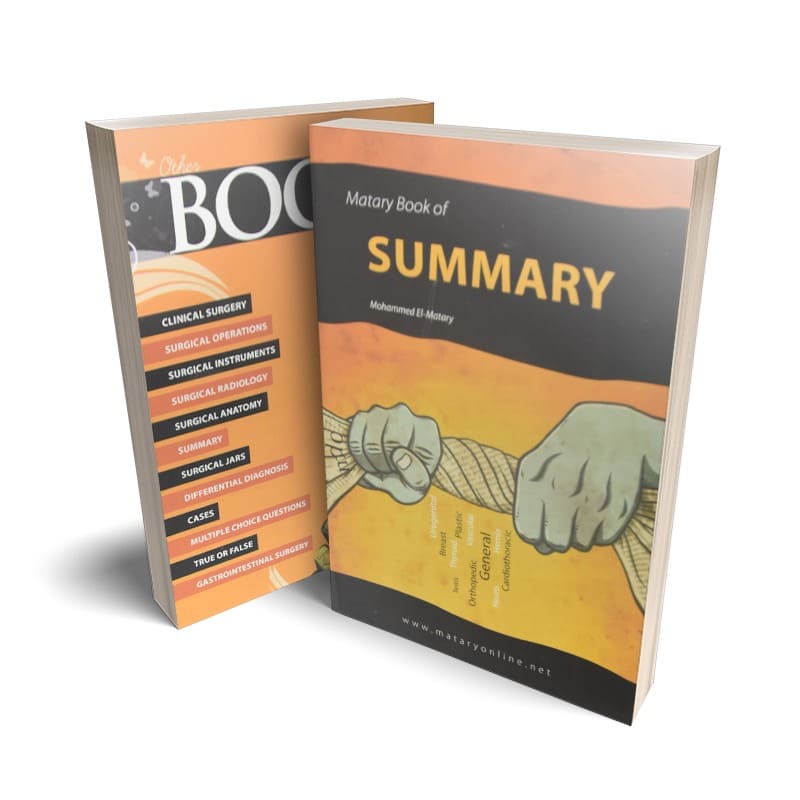 كتاب Matary Book of Summary - Summary of Surgery للدكتور محمد المطري - جامعة عين شمس - طلاب الفرقة السادسة